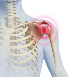 shoulder pain 5 red flags