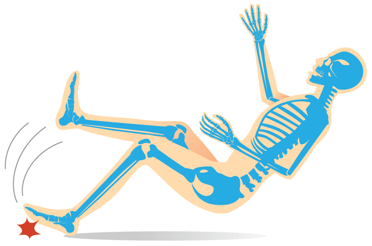 illustration of skeleton falling